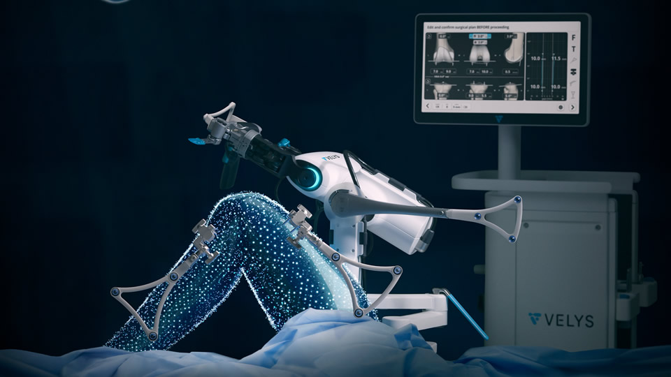 Robotergestützte Knieendoprothetik mit dem VELYS-System