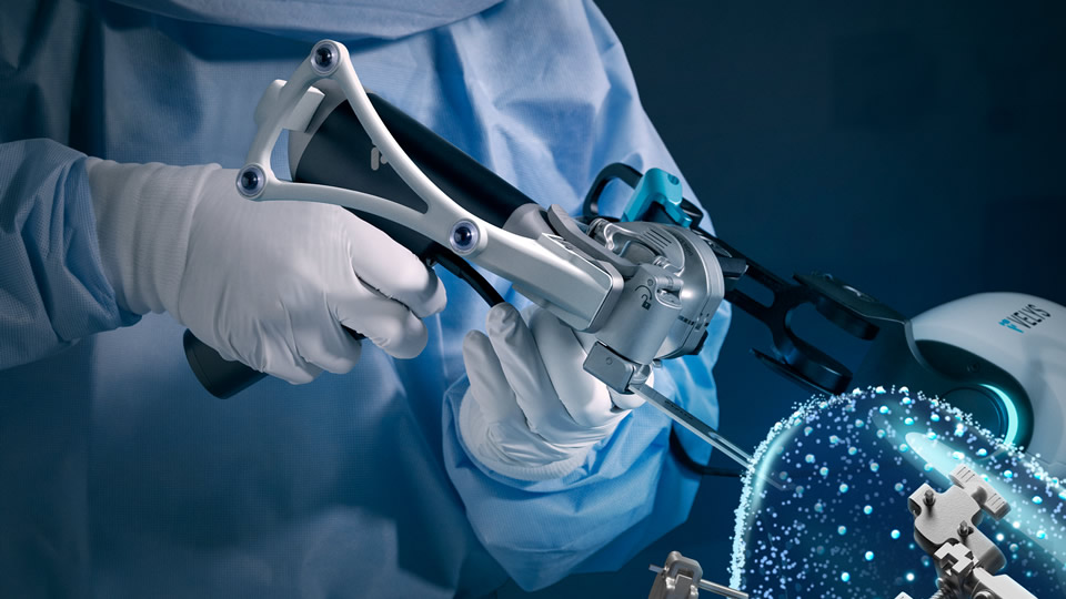 robotergestuetzte knieendoprothetik mit dem velys system 02